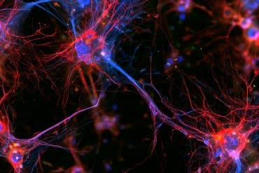 This shows microglia and neurons.