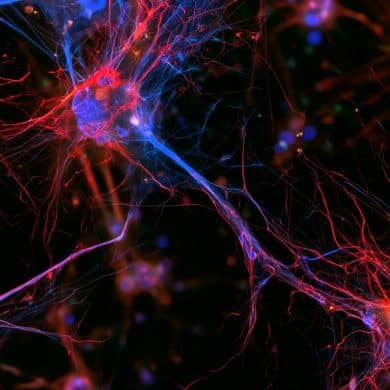 This shows microglia and neurons.