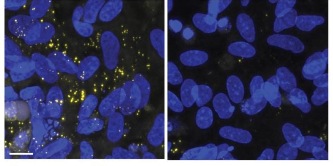 This shows oligodendrocyte.