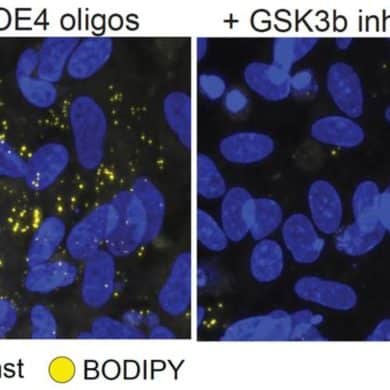 This shows oligodendrocyte.