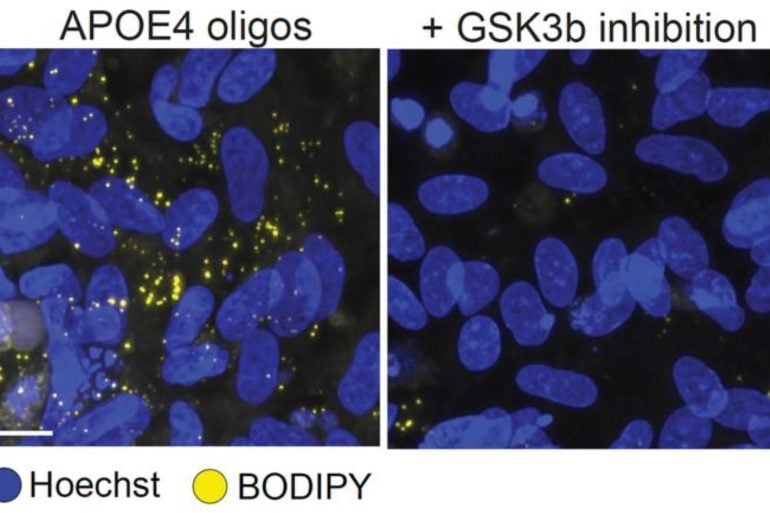 This shows oligodendrocyte.