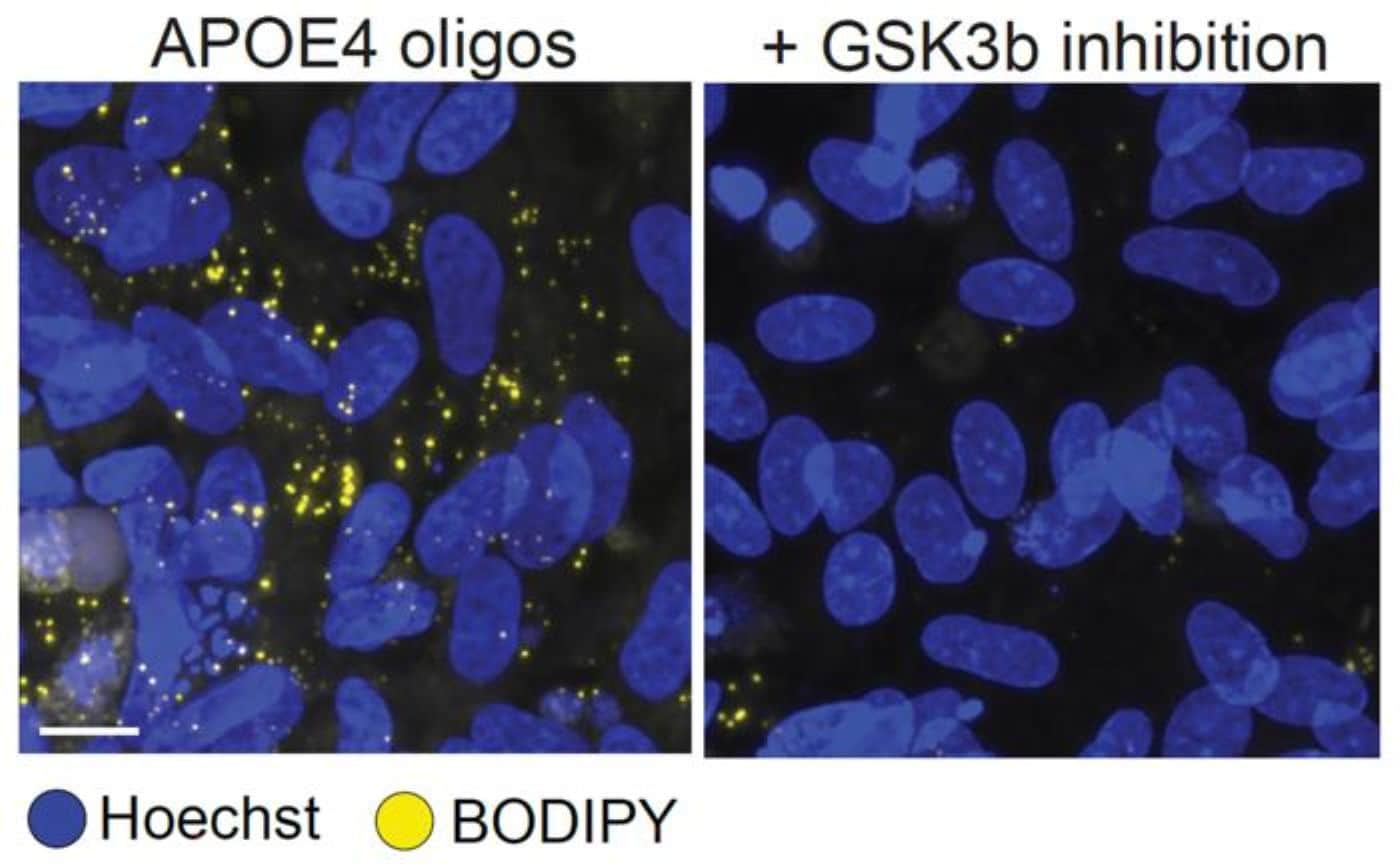 This shows oligodendrocyte.