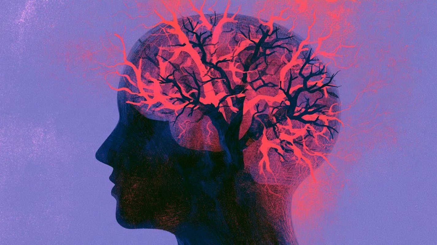 This shows the outline of a woman and a brain.