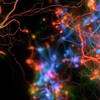 This shows neurons.