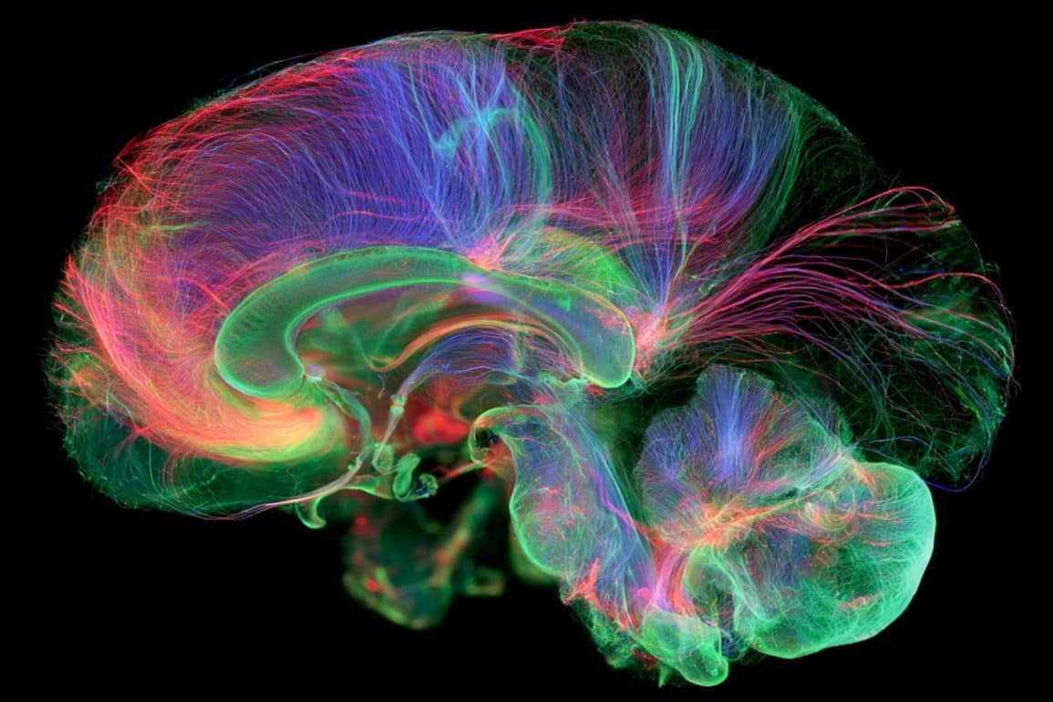 Premature Birth Alters Cerebellar Wiring