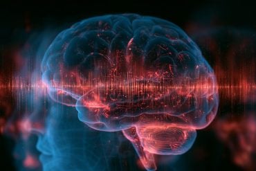 This shows a brain.