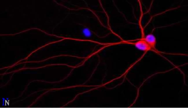 Rat neurons are shown as red in a culture dish.