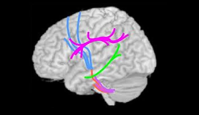 A brain is shown with different pathways highlighted.