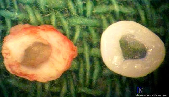 A natural rat IVD and a bioengineered IVD are shown in the picture.