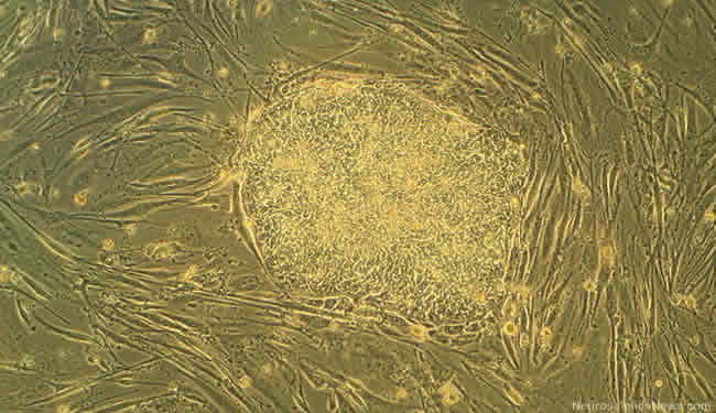 A colony of human embryonic stem cells is shown.