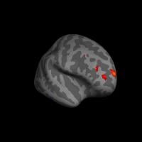 Introspective People Larger Prefrontal Cortex