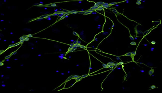  A few highlighted nerve cells are shown.