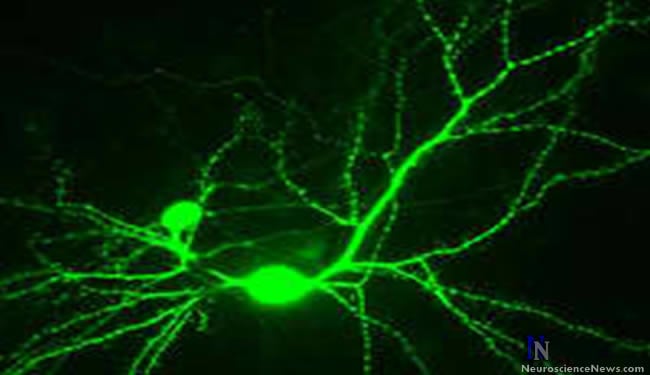 Neurons are shown in this image.