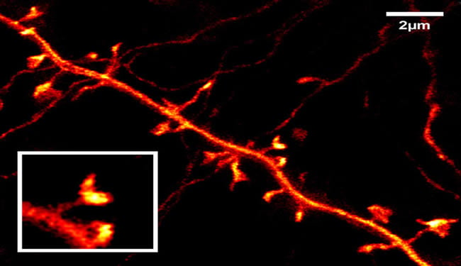 mch neurons mouse brain