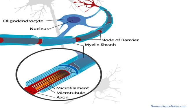 Drawing of a neuron axon area with oligodendrocytes and myelin sheath labeled.