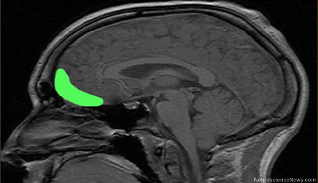 MRI image has the orbitofrontal cortex area highlighted.