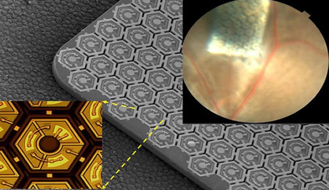 Photovoltaic chip and retinal prosthesis shown and described in caption.